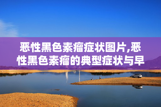 恶性黑色素瘤症状图片,恶性黑色素瘤的典型症状与早期识别要点 恶性黑色素瘤症状图片,恶性黑色素瘤的典型症状与早期识别要点